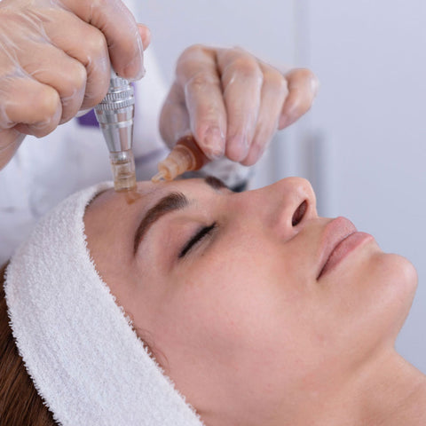 Microneedling